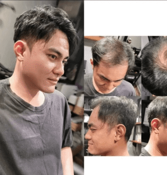 {{brizy_dc_image_alt entityId=